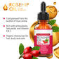 Moisturizing Rosehip Oil