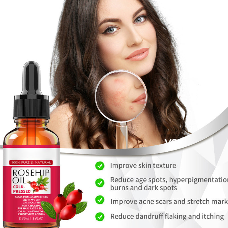 Moisturizing Rosehip Oil