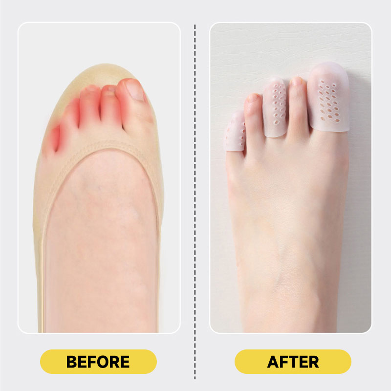 Large Toe Protectors （10 pcs)