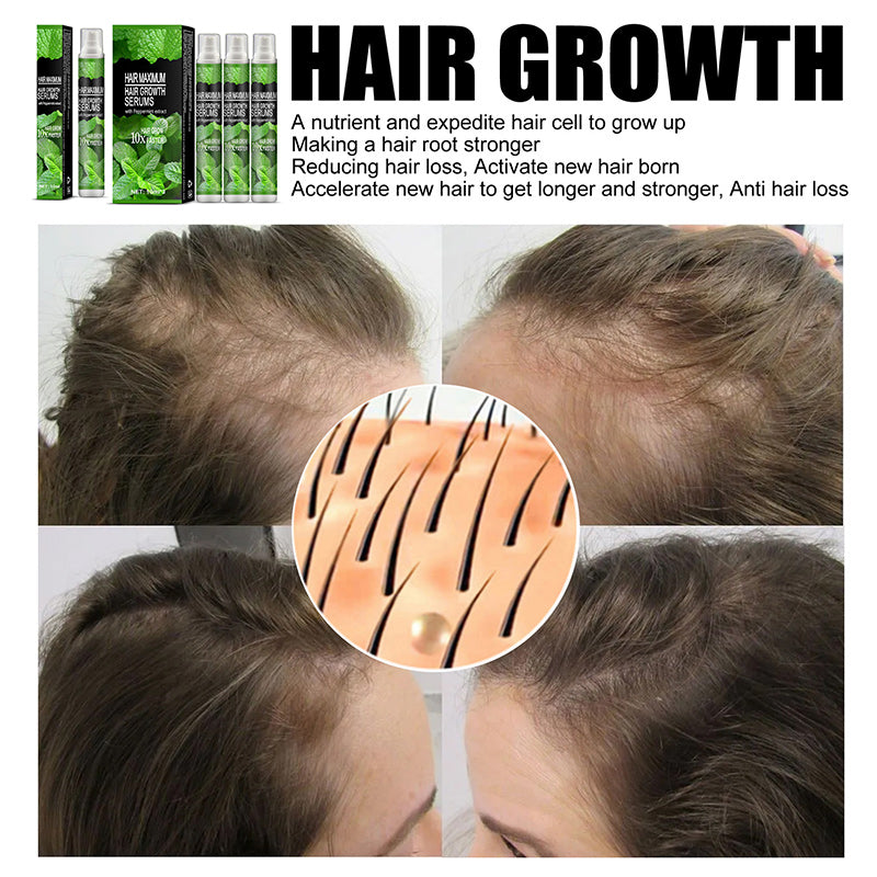 Herbal Hair-Growth Essence Spray