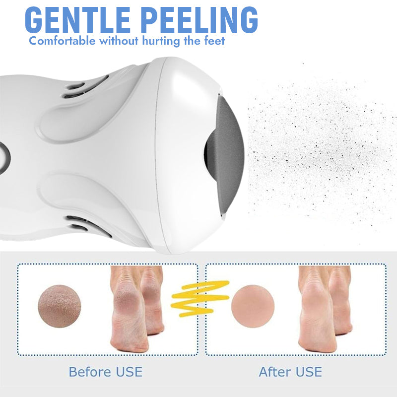 Electric Foot Grinder To Remove Dead Skin