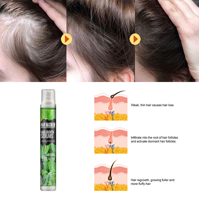 Herbal Hair-Growth Essence Spray