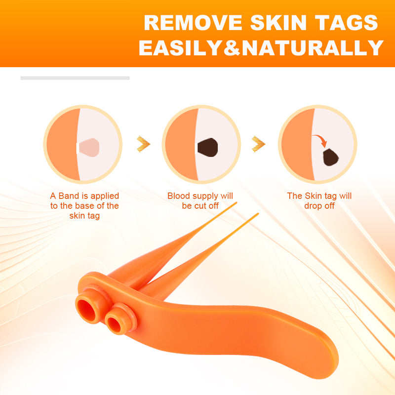 Skin Tag Remover