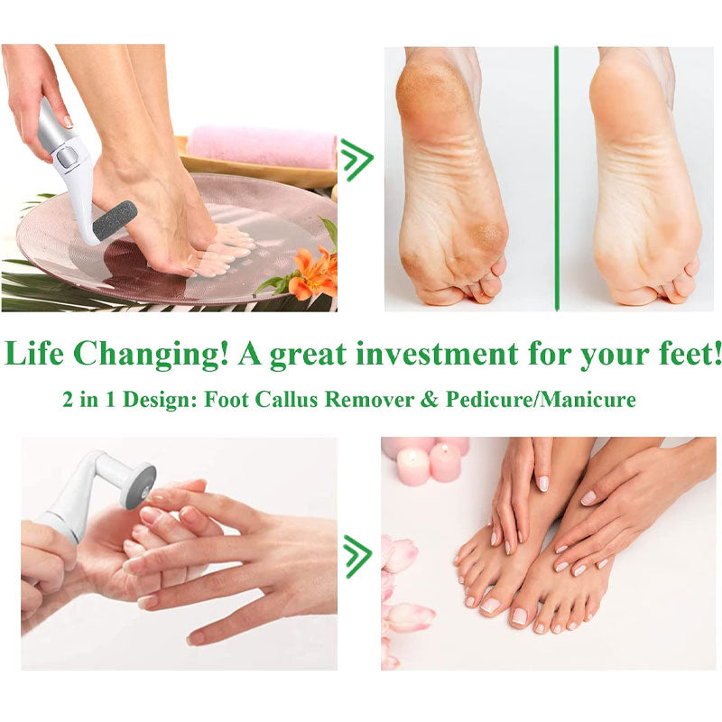 USB Rechargeable Foot Grinder