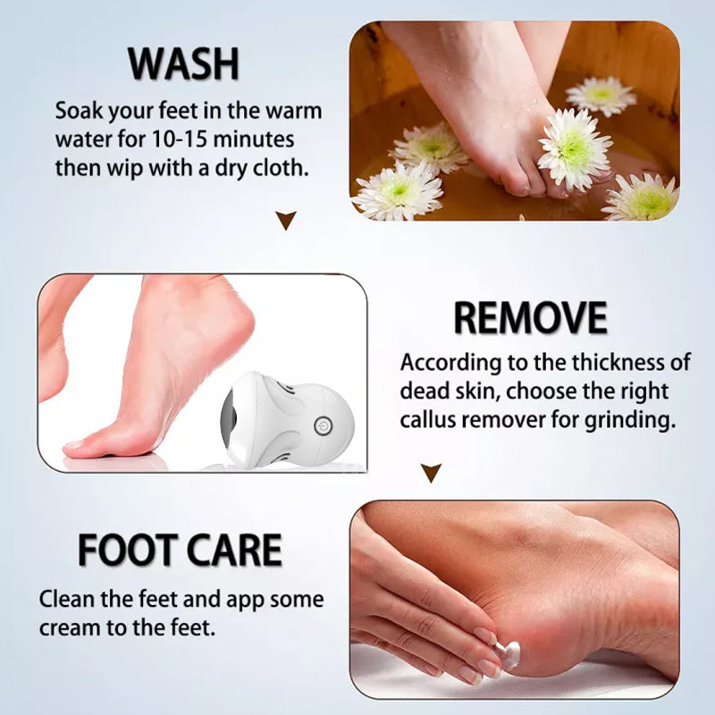 Electric Foot Grinder To Remove Dead Skin