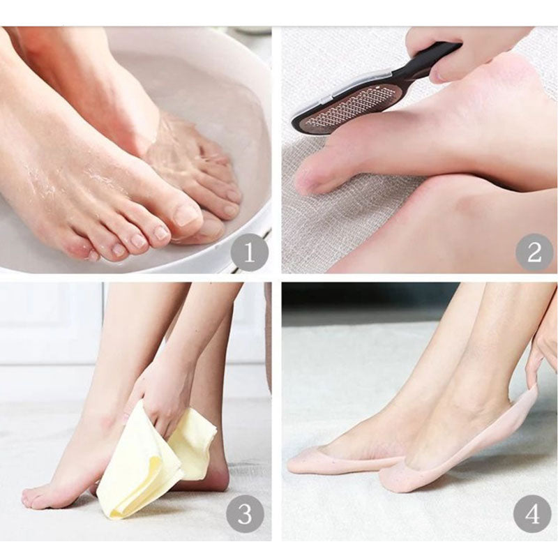 Stainless Steel Foot File Exfoliating Pedicure Device