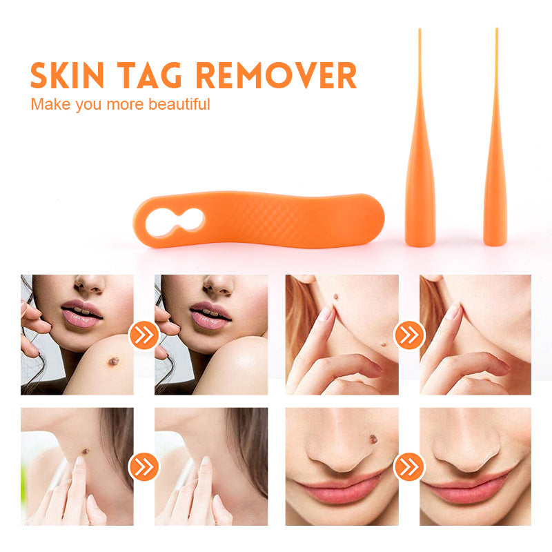 Skin Tag Remover