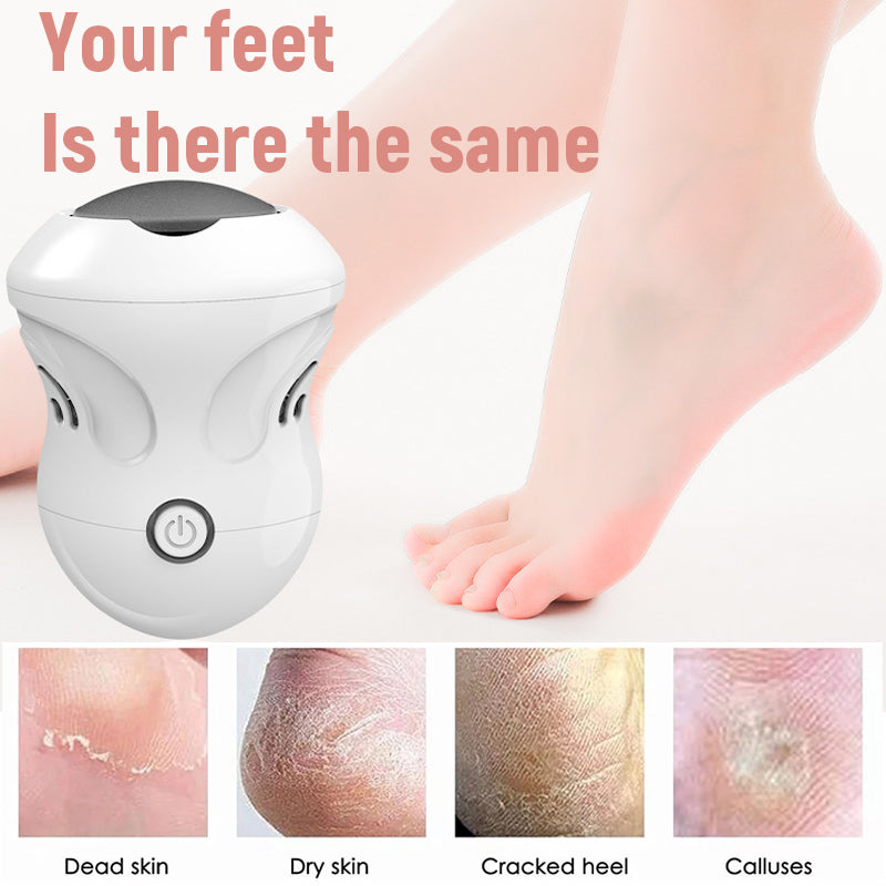 Electric Foot Grinder To Remove Dead Skin