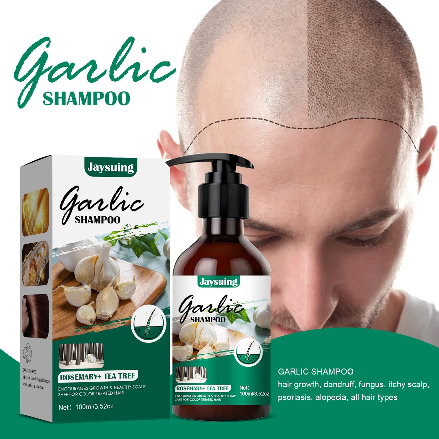 🎉Last Day 50% OFF | Hair Regrowth Garlic Shampoo